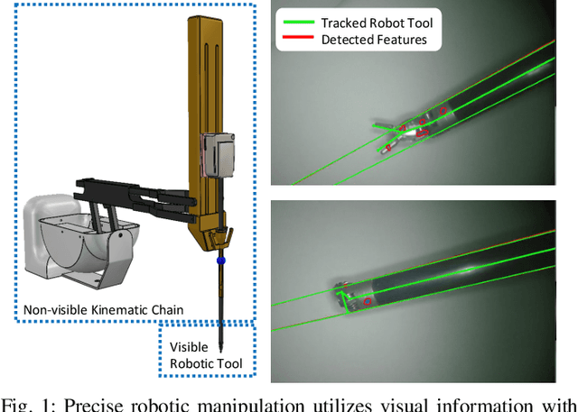Figure 1 for Robotic Tool Tracking under Partially Visible Kinematic Chain: A Unified Approach