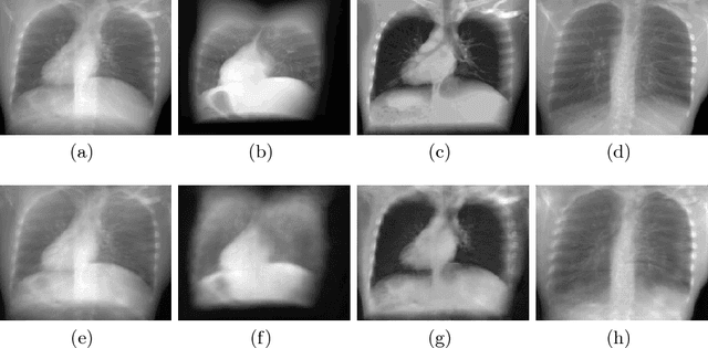 Figure 1 for X-ray In-Depth Decomposition: Revealing The Latent Structures