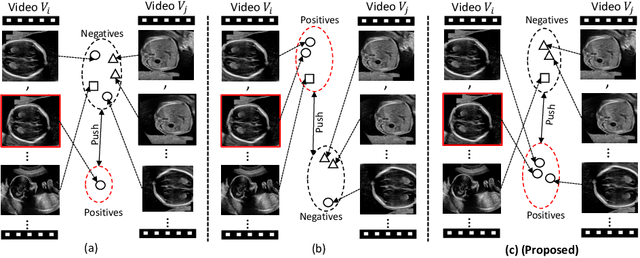 Figure 1 for Anatomy-Aware Contrastive Representation Learning for Fetal Ultrasound
