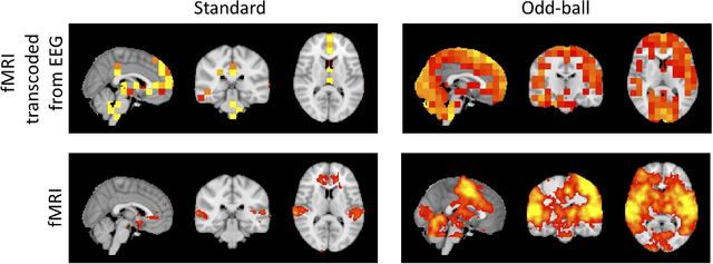 Figure 3 for Latent neural source recovery via transcoding of simultaneous EEG-fMRI