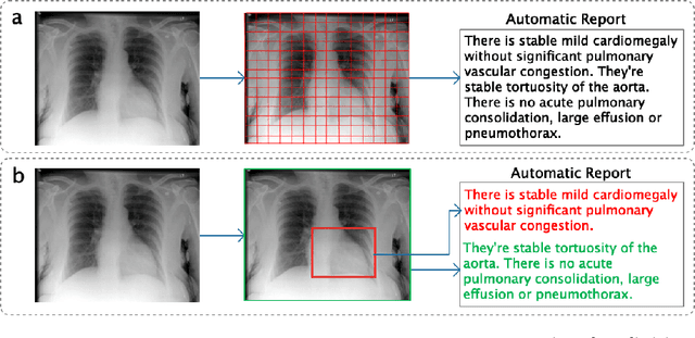 Figure 1 for Vispi: Automatic Visual Perception and Interpretation of Chest X-rays
