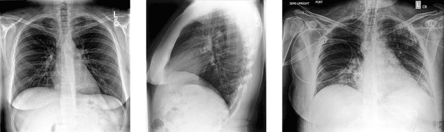Figure 1 for Deep Learning for Chest X-ray Analysis: A Survey