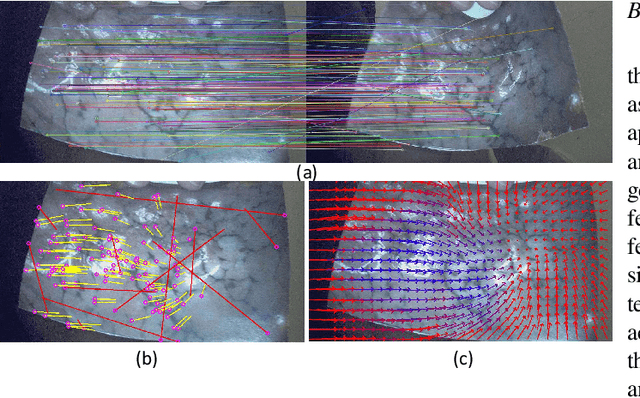 Figure 1 for Real-time Nonrigid Mosaicking of Laparoscopy Images