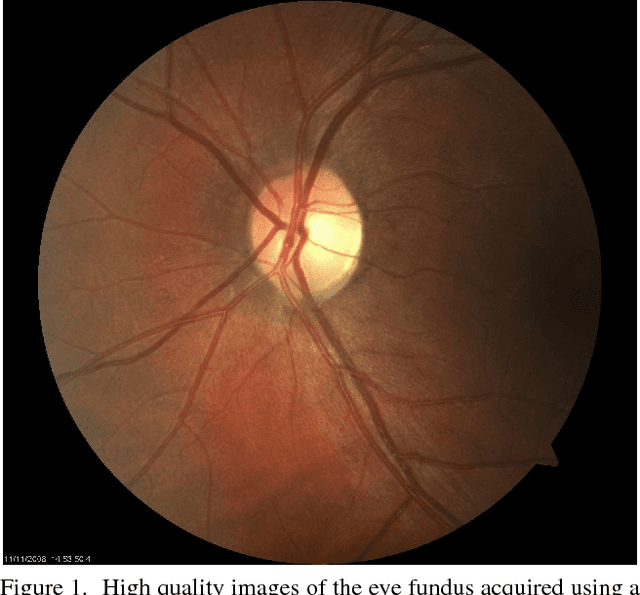 Figure 1 for Synthesising Wider Field Images from Narrow-Field Retinal Video Acquired Using a Low-Cost Direct Ophthalmoscope (Arclight) Attached to a Smartphone