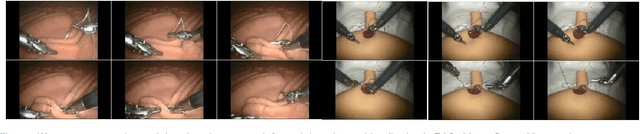 Figure 1 for Detection and Localization of Robotic Tools in Robot-Assisted Surgery Videos Using Deep Neural Networks for Region Proposal and Detection
