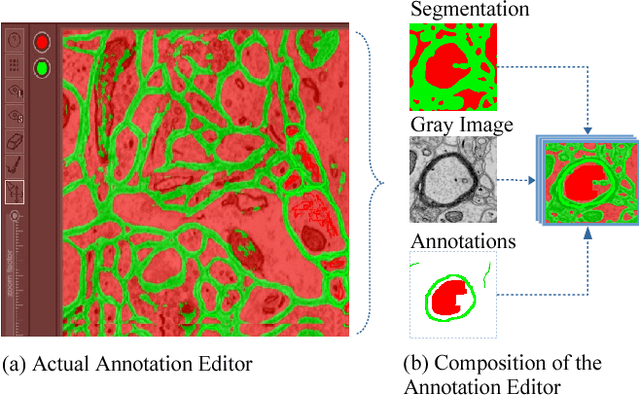 Figure 1 for Icon: An Interactive Approach to Train Deep Neural Networks for Segmentation of Neuronal Structures