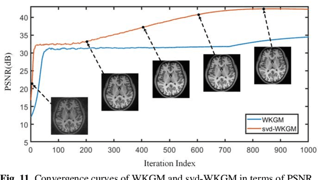 Figure 3 for WKGM: Weight-K-space Generative Model for Parallel Imaging Reconstruction