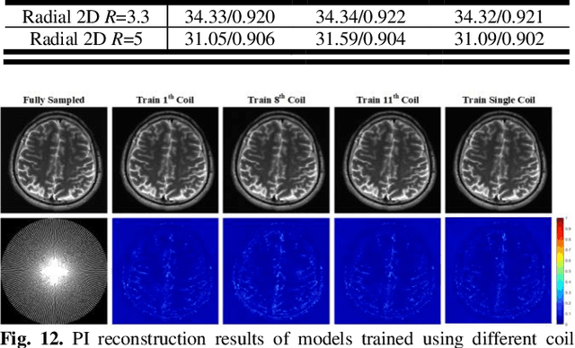 Figure 4 for WKGM: Weight-K-space Generative Model for Parallel Imaging Reconstruction