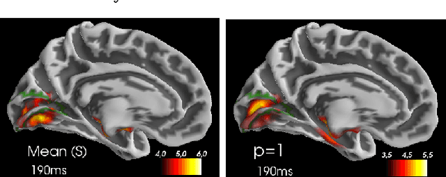 Figure 3 for Fast Optimal Transport Averaging of Neuroimaging Data