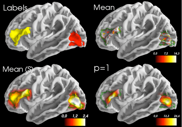 Figure 1 for Fast Optimal Transport Averaging of Neuroimaging Data