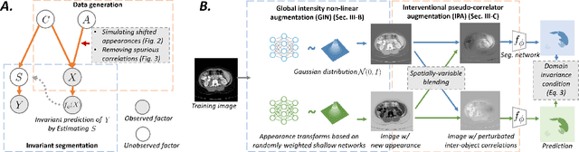 Figure 1 for Causality-inspired Single-source Domain Generalization for Medical Image Segmentation