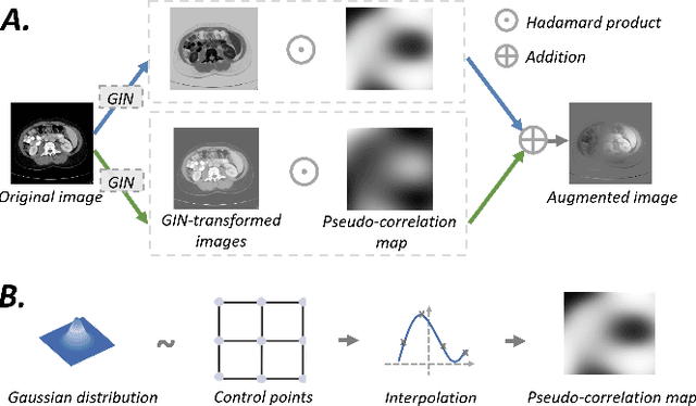 Figure 4 for Causality-inspired Single-source Domain Generalization for Medical Image Segmentation