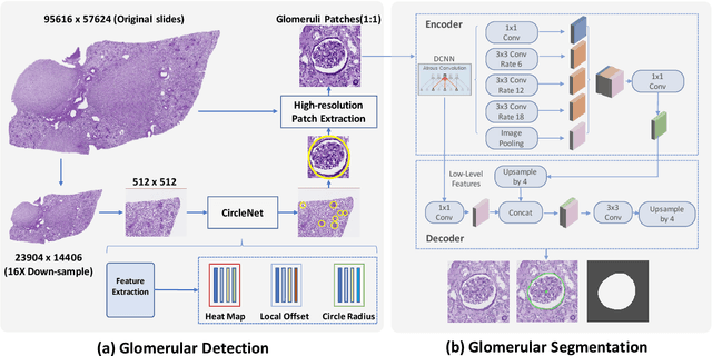 Figure 3 for Glo-In-One: Holistic Glomerular Detection, Segmentation, and Lesion Characterization with Large-scale Web Image Mining