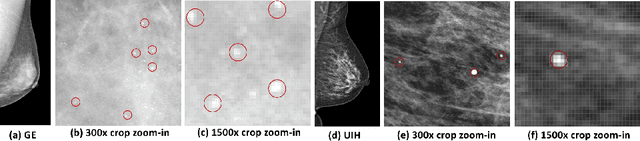 Figure 1 for mr2NST: Multi-Resolution and Multi-Reference Neural Style Transfer for Mammography