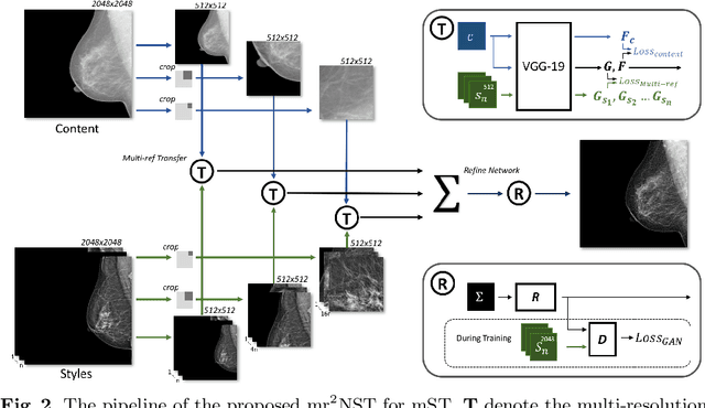 Figure 3 for mr2NST: Multi-Resolution and Multi-Reference Neural Style Transfer for Mammography