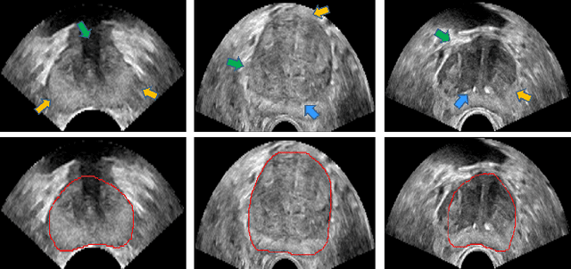 Figure 1 for Fine-grained Recurrent Neural Networks for Automatic Prostate Segmentation in Ultrasound Images