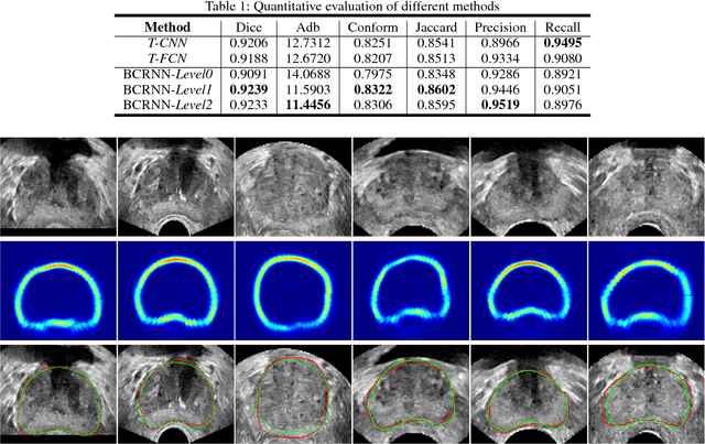Figure 2 for Fine-grained Recurrent Neural Networks for Automatic Prostate Segmentation in Ultrasound Images