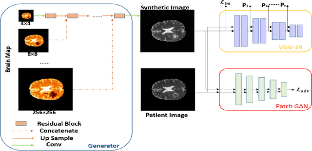 Figure 1 for Improvement of Multiparametric MR Image Segmentation by Augmenting the Data with Generative Adversarial Networks for Glioma Patients