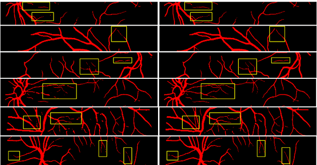 Figure 4 for ErrorNet: Learning error representations from limited data to improve vascular segmentation