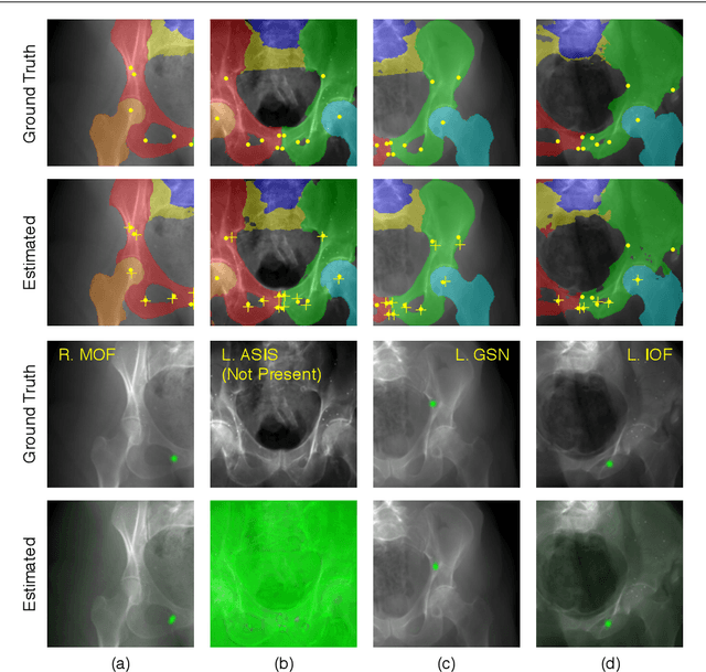 Figure 3 for Automatic Annotation of Hip Anatomy in Fluoroscopy for Robust and Efficient 2D/3D Registration
