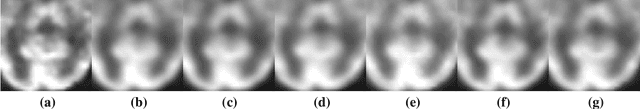 Figure 2 for Parameter Constrained Transfer Learning for Low Dose PET Image Denoising