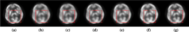 Figure 3 for Parameter Constrained Transfer Learning for Low Dose PET Image Denoising