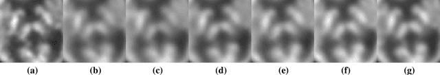 Figure 4 for Parameter Constrained Transfer Learning for Low Dose PET Image Denoising
