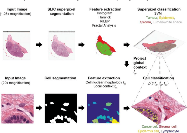 Figure 3 for Capturing global spatial context for accurate cell classification in skin cancer histology
