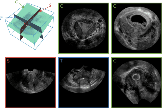 Figure 1 for Searching Collaborative Agents for Multi-plane Localization in 3D Ultrasound
