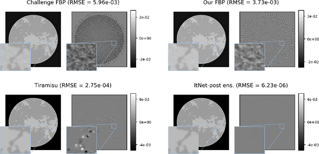 Figure 4 for AAPM DL-Sparse-View CT Challenge Submission Report: Designing an Iterative Network for Fanbeam-CT with Unknown Geometry