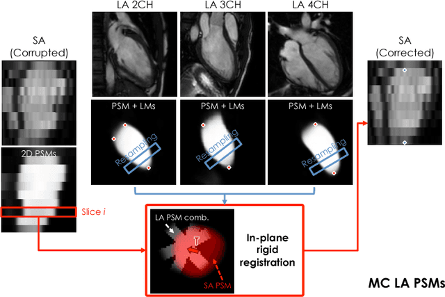 Figure 1 for A Comprehensive Approach for Learning-based Fully-Automated Inter-slice Motion Correction for Short-Axis Cine Cardiac MR Image Stacks