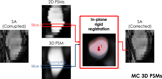 Figure 3 for A Comprehensive Approach for Learning-based Fully-Automated Inter-slice Motion Correction for Short-Axis Cine Cardiac MR Image Stacks