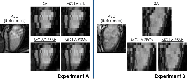 Figure 4 for A Comprehensive Approach for Learning-based Fully-Automated Inter-slice Motion Correction for Short-Axis Cine Cardiac MR Image Stacks