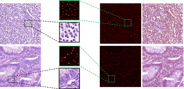 Figure 3 for Nuclei Detection Using Mixture Density Networks