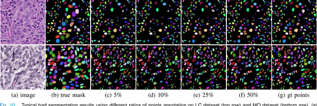 Figure 2 for Weakly Supervised Deep Nuclei Segmentation Using Partial Points Annotation in Histopathology Images