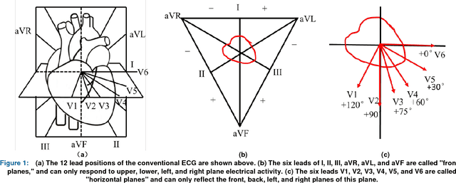 Figure 1 for A Study of Deep Feature Fusion based Methods for Classifying Multi-lead ECG