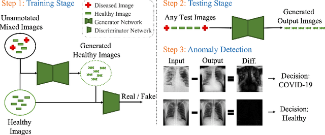 Figure 1 for HealthyGAN: Learning from Unannotated Medical Images to Detect Anomalies Associated with Human Disease