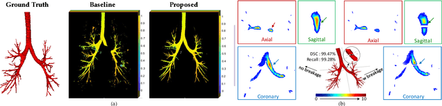 Figure 1 for Differentiable Topology-Preserved Distance Transform for Pulmonary Airway Segmentation