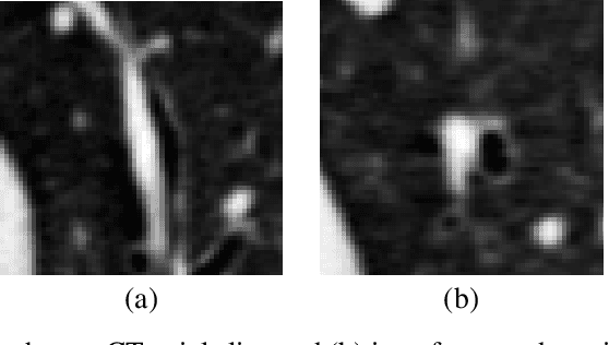 Figure 3 for Generative-based Airway and Vessel Morphology Quantification on Chest CT Images