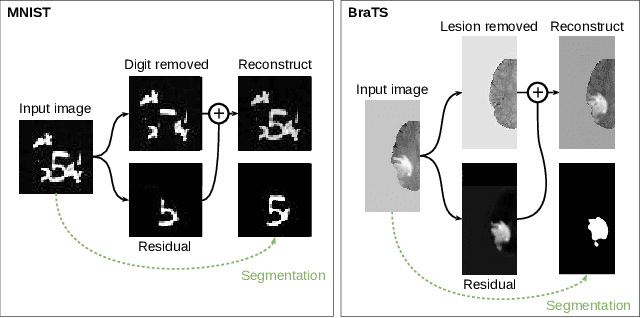 Figure 1 for Boosting segmentation with weak supervision from image-to-image translation