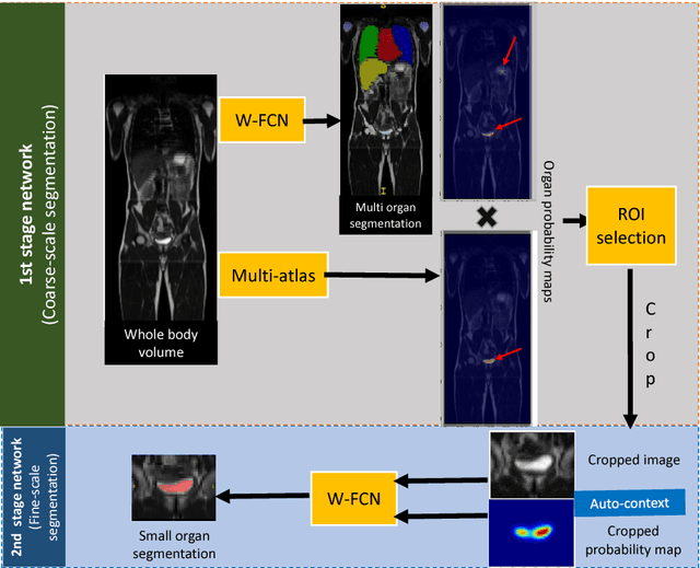 Figure 1 for Small Organ Segmentation in Whole-body MRI using a Two-stage FCN and Weighting Schemes