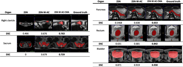 Figure 3 for Small Organ Segmentation in Whole-body MRI using a Two-stage FCN and Weighting Schemes