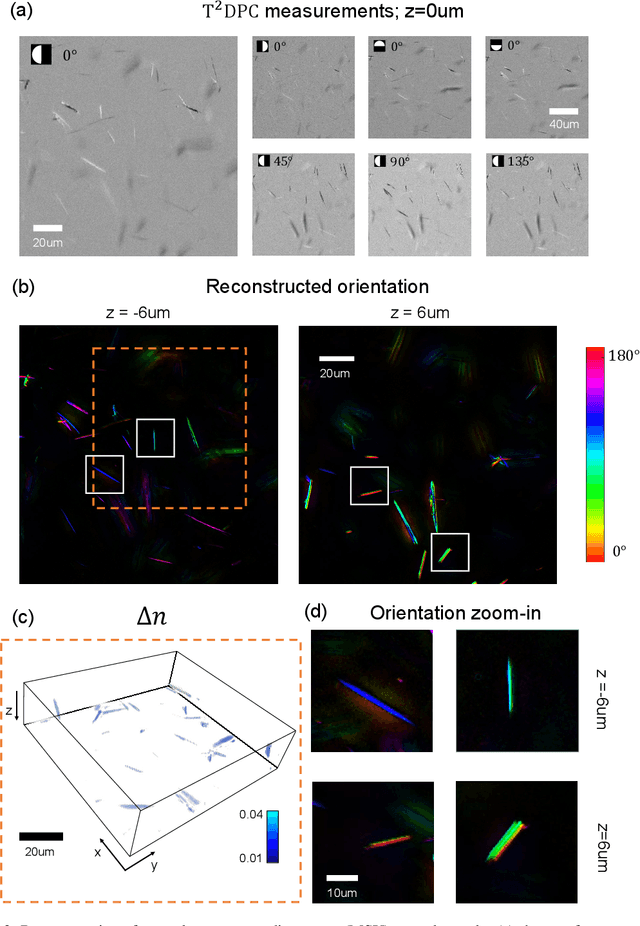 Figure 2 for Tensorial tomographic differential phase-contrast microscopy