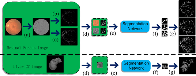 Figure 3 for Hierarchical Deep Network with Uncertainty-aware Semi-supervised Learning for Vessel Segmentation