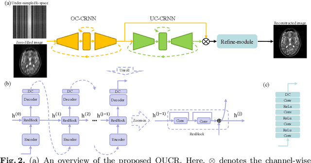 Figure 3 for Over-and-Under Complete Convolutional RNN for MRI Reconstruction