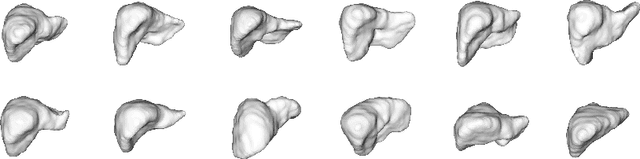 Figure 3 for 3D Organ Shape Reconstruction from Topogram Images
