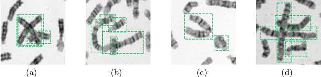 Figure 1 for DeepACE: Automated Chromosome Enumeration in Metaphase Cell Images Using Deep Convolutional Neural Networks