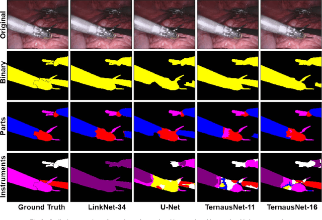 Figure 3 for Automatic Instrument Segmentation in Robot-Assisted Surgery Using Deep Learning