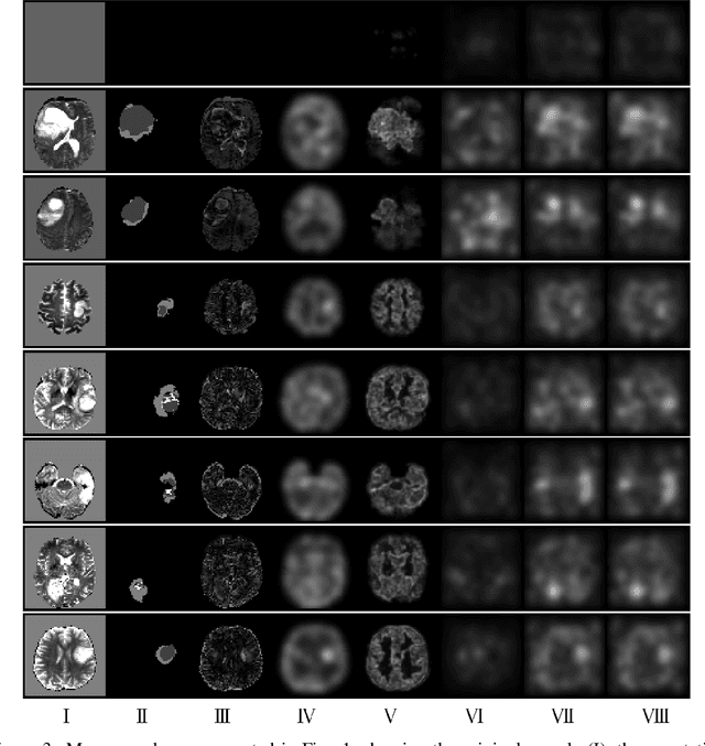 Figure 4 for A Case for the Score: Identifying Image Anomalies using Variational Autoencoder Gradients