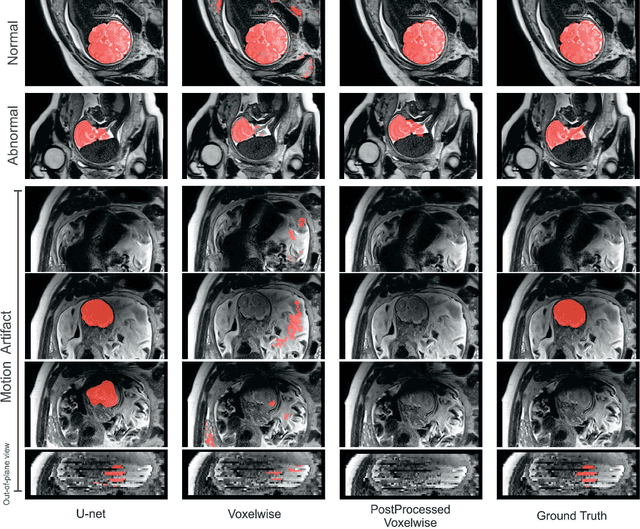Figure 3 for Real-Time Automatic Fetal Brain Extraction in Fetal MRI by Deep Learning